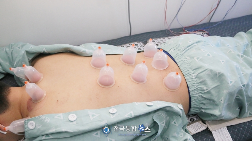 굿모닝한방병원 부황치료 모습./전국통합뉴스=이승주 기자