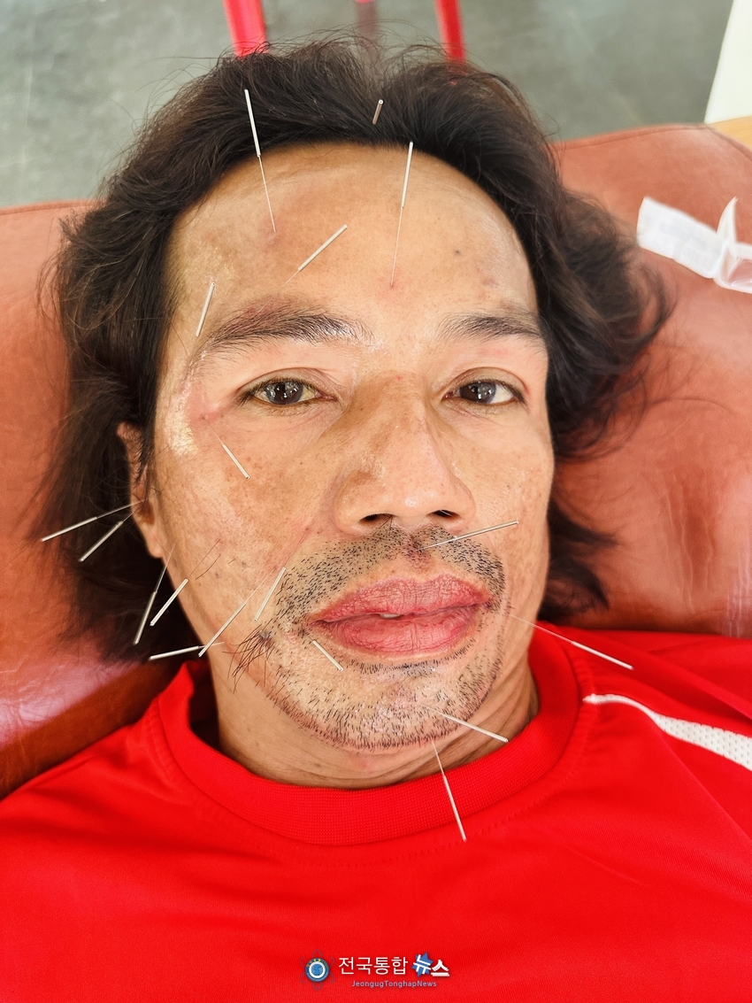 2년 동안 안면신경마비로 눈이 감기지 않는 환자가 침치료를 받고 있다. / Joy Jung 자료제공
